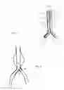 Fig. 06 - Intraluminal polymeric devices for the treatment of aneurysms