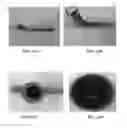 Fig. 20 - Intraluminal polymeric devices for the treatment of aneurysms