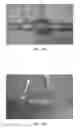 Fig. 26 - Intraluminal polymeric devices for the treatment of aneurysms