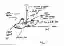 Fig. 02 - Dual endovascular filter and methods of use