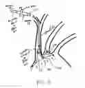 Fig. 07 - Dual endovascular filter and methods of use