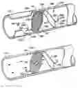 Fig. 01 - Distal protection devices and methods of providing distal protection