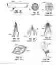 Fig. 02 - Distal protection devices and methods of providing distal protection