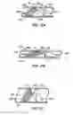 Fig. 03 - Distal protection devices and methods of providing distal protection