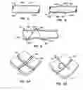 Fig. 04 - Distal protection devices and methods of providing distal protection
