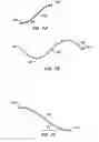 Fig. 06 - Distal protection devices and methods of providing distal protection