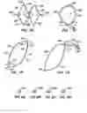 Fig. 07 - Distal protection devices and methods of providing distal protection