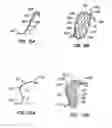 Fig. 08 - Distal protection devices and methods of providing distal protection