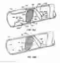 Fig. 14 - Distal protection devices and methods of providing distal protection