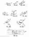 Fig. 17 - Distal protection devices and methods of providing distal protection