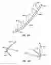 Fig. 20 - Distal protection devices and methods of providing distal protection
