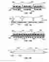 Fig. 23 - Distal protection devices and methods of providing distal protection