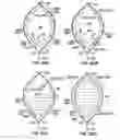 Fig. 25 - Distal protection devices and methods of providing distal protection