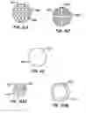 Fig. 30 - Distal protection devices and methods of providing distal protection