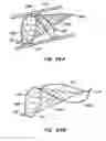 Fig. 31 - Distal protection devices and methods of providing distal protection