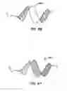 Fig. 33 - Distal protection devices and methods of providing distal protection