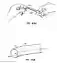 Fig. 34 - Distal protection devices and methods of providing distal protection