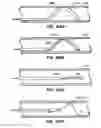 Fig. 35 - Distal protection devices and methods of providing distal protection