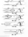 Fig. 43 - Distal protection devices and methods of providing distal protection