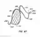 Fig. 51 - Distal protection devices and methods of providing distal protection