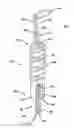 Fig. 01 - Adjustable anchor systems and methods