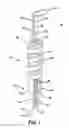 Fig. 02 - Adjustable anchor systems and methods