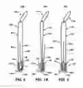 Fig. 03 - Adjustable anchor systems and methods