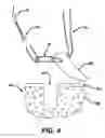 Fig. 04 - Adjustable anchor systems and methods
