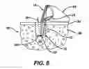 Fig. 08 - Adjustable anchor systems and methods
