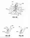 Fig. 09 - Adjustable anchor systems and methods