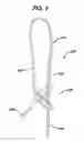 Fig. 10 - Adjustable anchor systems and methods