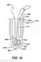 Fig. 11 - Adjustable anchor systems and methods