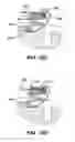 Fig. 15 - Adjustable anchor systems and methods