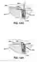 Fig. 17 - Adjustable anchor systems and methods