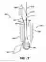Fig. 23 - Adjustable anchor systems and methods