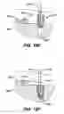 Fig. 26 - Adjustable anchor systems and methods
