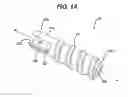 Fig. 02 - Suture anchor with pulley