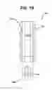 Fig. 03 - Suture anchor with pulley