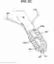 Fig. 08 - Suture anchor with pulley