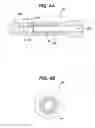 Fig. 09 - Suture anchor with pulley