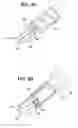 Fig. 10 - Suture anchor with pulley