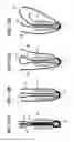 Fig. 16 - Suture anchor with pulley