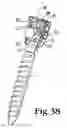 Fig. 13 - Polyaxial bone anchor with compound articulation and pop-on shank