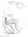 Fig. 01 - Methods and systems for determining if an arrhythmia initiated in an atrium or a ventricle