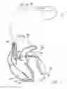 Fig. 02 - Methods and systems for determining if an arrhythmia initiated in an atrium or a ventricle