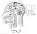 Fig. 01 - APPLICATIONS OF THE STIMULATION OF NEURAL TISSUE USING LIGHT