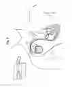 Fig. 06 - APPLICATIONS OF THE STIMULATION OF NEURAL TISSUE USING LIGHT