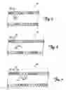 Fig. 04 - RF rejecting lead