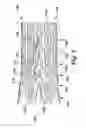 Fig. 03 - STENT HAVING VARIABLE STIFFNESS