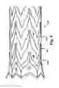 Fig. 04 - STENT HAVING VARIABLE STIFFNESS